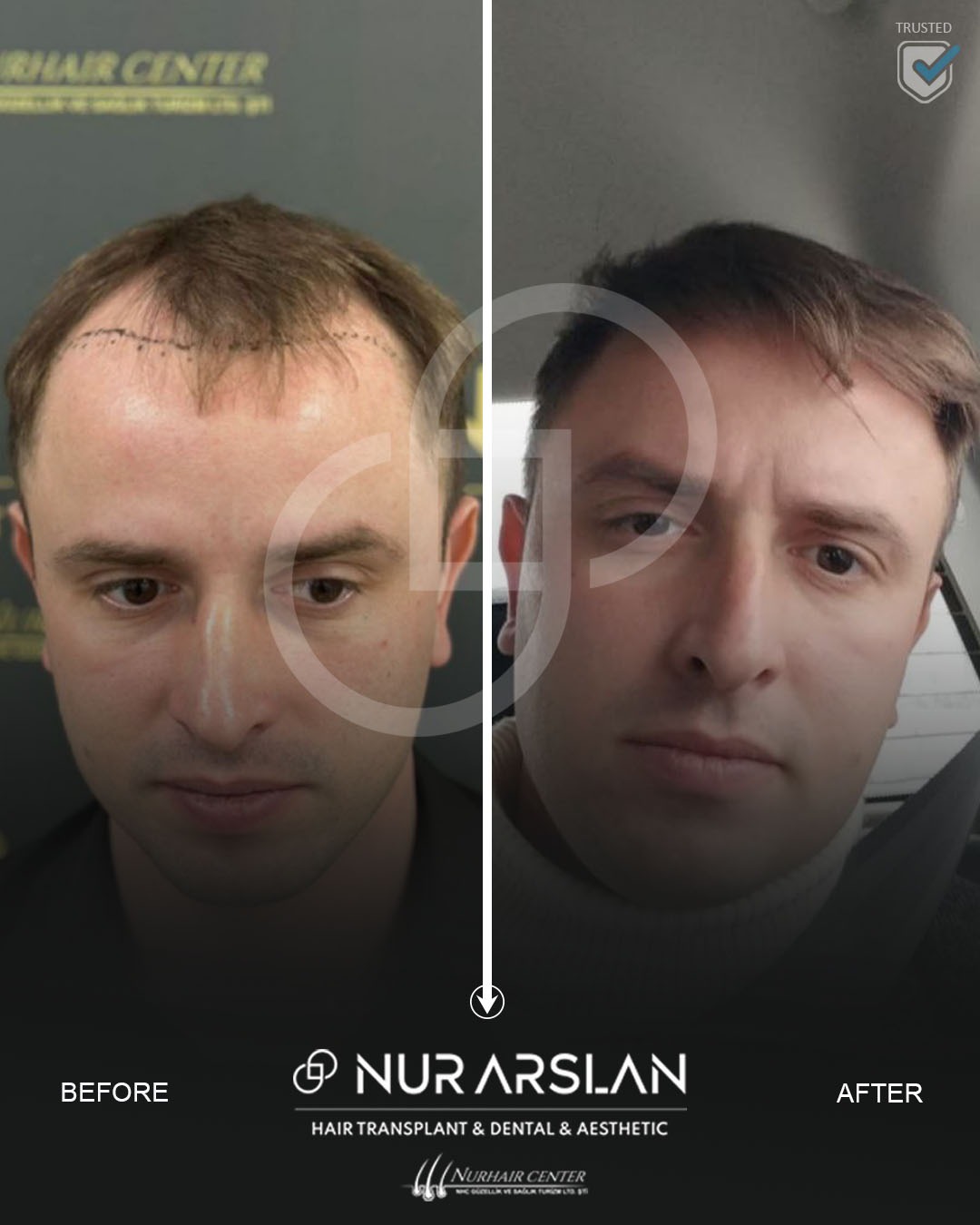 Акции