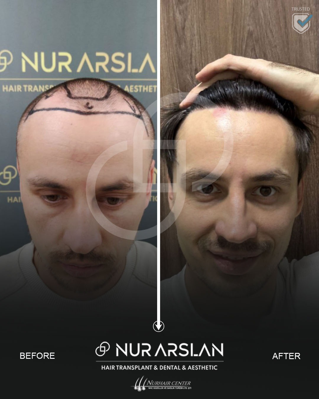 Акции