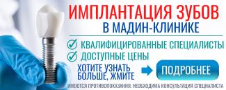 Имплантация зубов